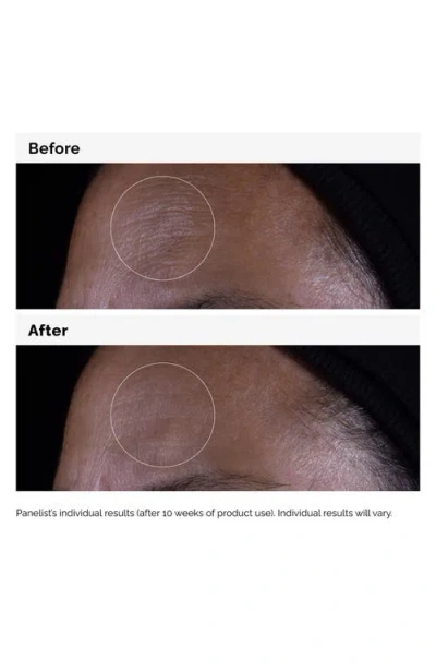 The Ordinary Gf 15% Solution In No Color