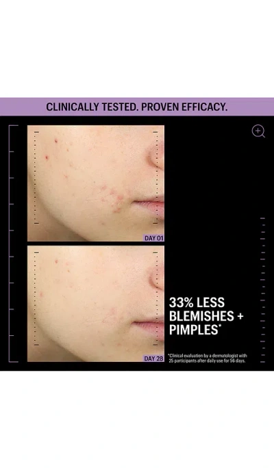 Allies Of Skin Azelaic And Kojic Advanced Clarifying Serum 30ml In Beauty: Na