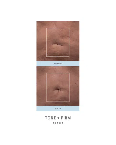 Nuface Nubody Skin Toning Device