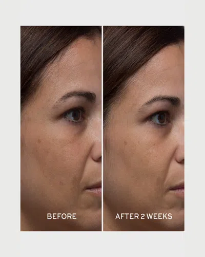 Elemis Pro-collagen Tri-acid Peel 30ml In White