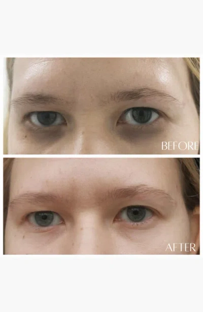 Botanicary No. 8 Reawaken 24k Gold Illuminating Eye Elixir In Gold