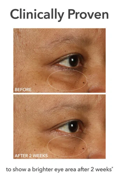 Dr Dennis Gross Skincare Dr. Dennis Gross Skincare Derminfusions™ Fill + Repair Eye Cream In No Color