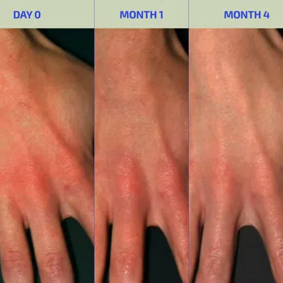 Codex Labs Corp Codex Labs: Bia Eczema Relief Lotion