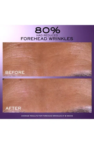 Lancôme Rénergie C.r.x Triple Eye Serum 50ml In No Color