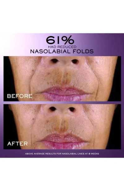 Lancôme Rénergie C.r.x Triple Eye Serum 50ml In No Color