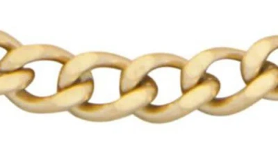 St. Moran Set Of 3 Assorted Chain Anklets