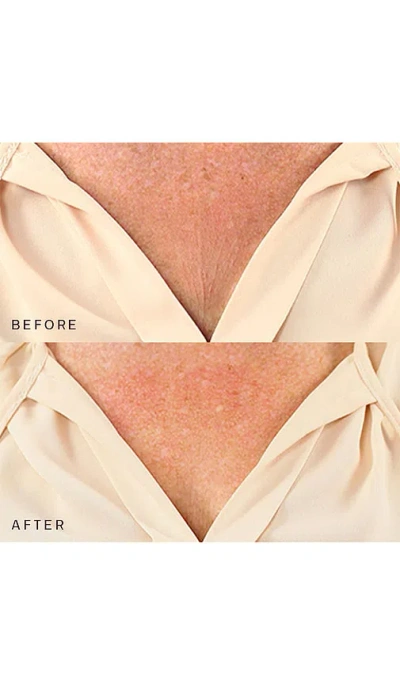 Dermaclara Decollette, Breast & Butt Occlusion Patch