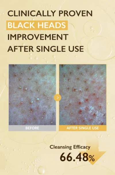 Haruharu Wonder Black Rice Moisture Deep Cleansing Oil 150ml