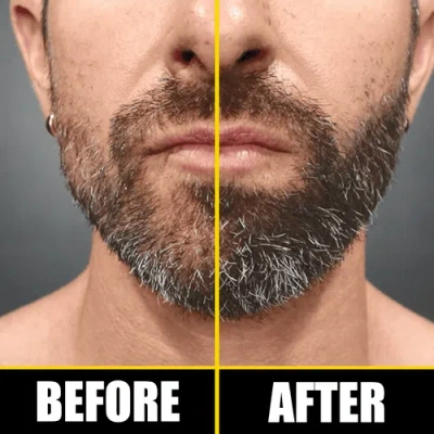 Pete & Pedro Boost Hair & Beard Growth Strengthening Serum With Biotin & Rosemary