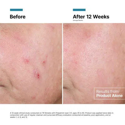 Skinceuticals Advanced Rgn-6 Regenerative Cream