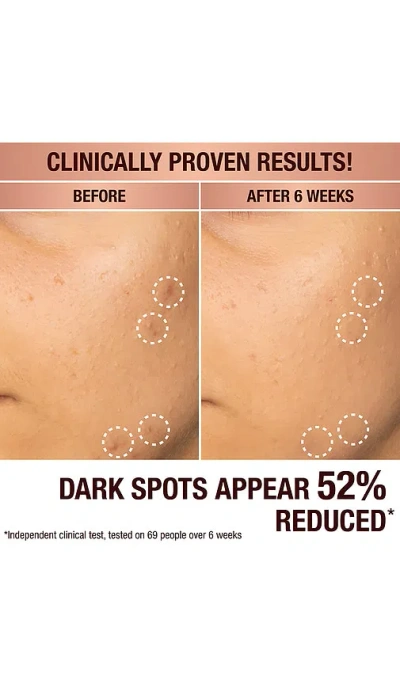 Charlotte Tilbury Dark Spot Correcting Radiance Recovery Serum 30ml
