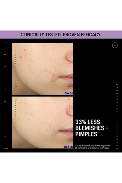 Allies Of Skin Azelaic And Kojic Advanced Clarifying Serum 30ml