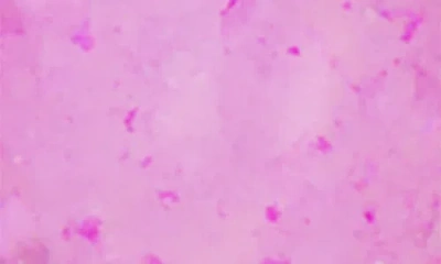 Saachi Druzy Adorned Hoop Earrings 613460 In Gold