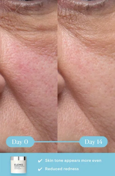 Elemis Dynamic Resurfacing Facial Pads