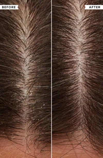 Philip Kingsley Flaky Scalp Shampoo