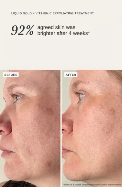 Alpha-h Liquid Gold Exfoliating Treatment With Vitamin C 100ml-no Color