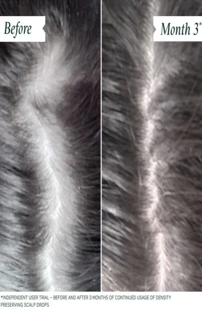 Philip Kingsley Density Preserving Scalp Drops In Default Title
