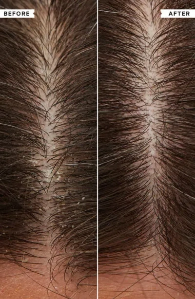 Philip Kingsley Flaky Scalp Calming Scalp Toner In Transparent