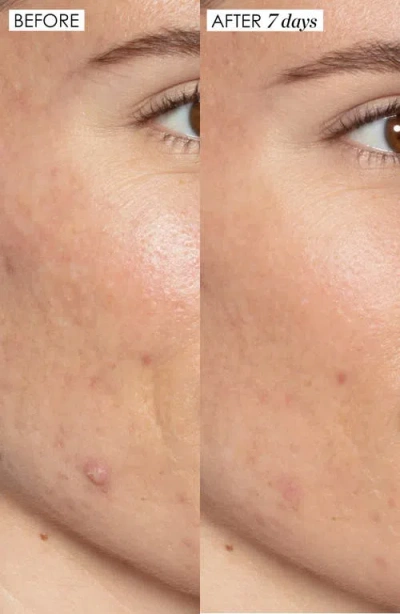 Sunday Riley Jumbo Good Genes All-in-one Lactic Acid Exfoliating Face Treatment $284 Value