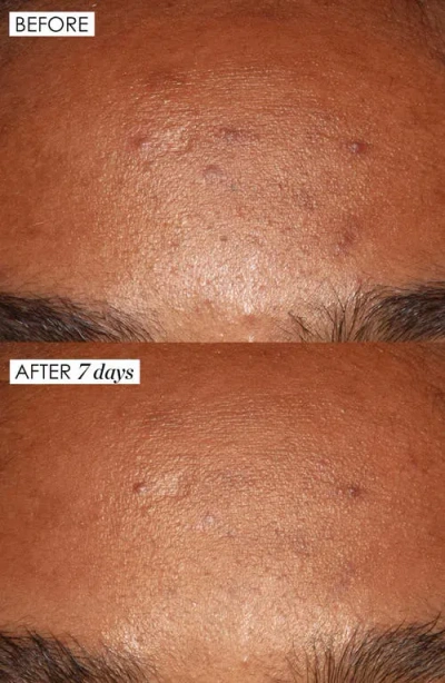 Sunday Riley Jumbo Good Genes All-in-one Lactic Acid Exfoliating Face Treatment $284 Value