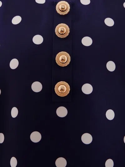 波点纽扣连衣裙