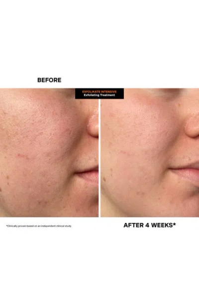 Kate Somerville ® Exfolikate® Intensive Exfoliating Treatment Duo (nordstrom Exclusive) $158 Value