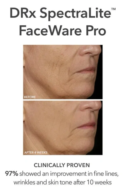 Dr Dennis Gross Skincare Dr. Dennis Gross Skincare Plump, Glow & Boost Collagen Set $568 Value