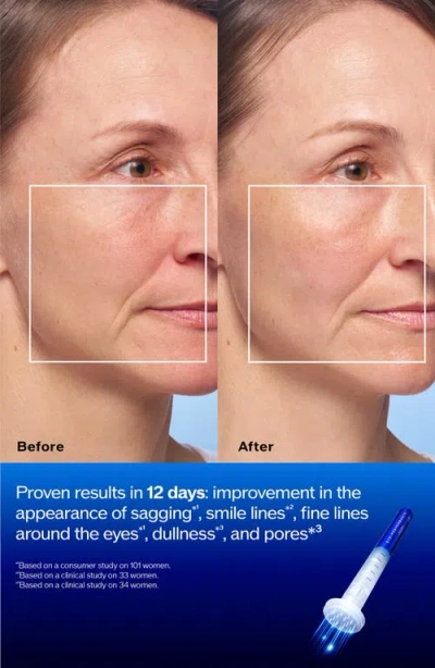 Shiseido Bio-performance Micro-click Concentrate In Blue