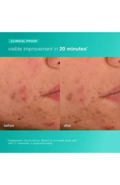 Dermalogica Acne Biotic Moisturizer In Transparent