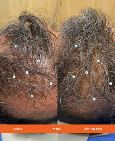 Ds Laboratories 2-pc. Revita High-performance Hair Density Shampoo & Conditioner Set In Transparent