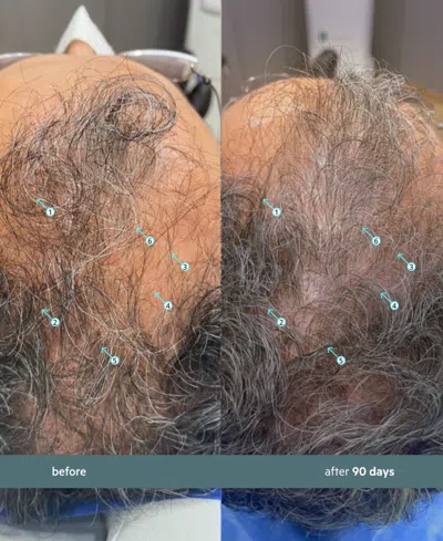 Ds Laboratories Spectral.f7 Booster With Astressin-b, 60 ml In Transparent