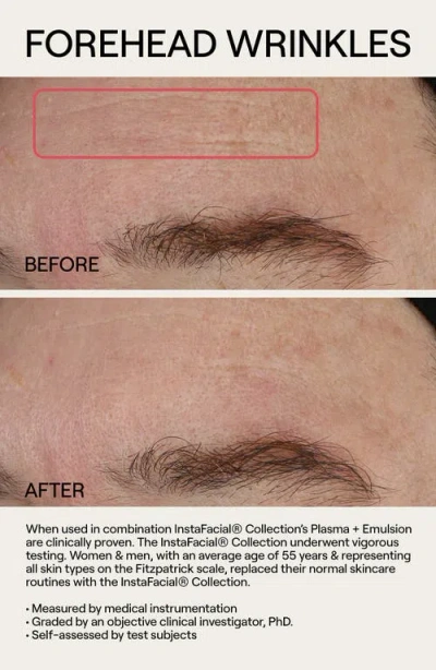 Dr. Diamond’s Metacine Travel Instafacial Plasma Bioactive Growth Factor Serum In Multi