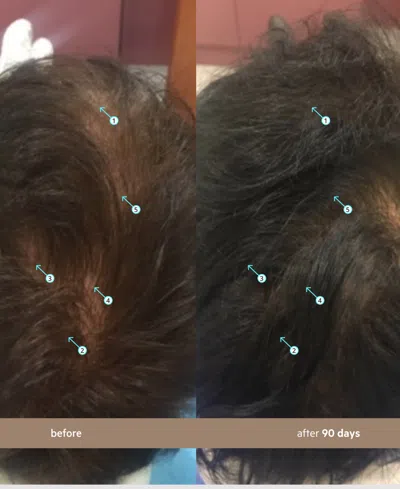 Ds Laboratories Spectral.dnc-n Hair Density Serum With Nanoxidil 5%, 60 ml In Transparent