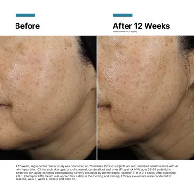 Skinceuticals A.g.e. Interrupter Ultra Lifting Serum