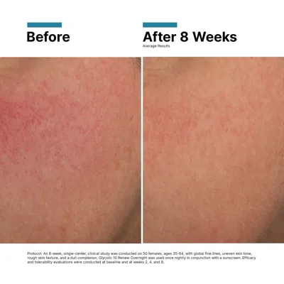 Bluemercury Glycolic 10 Renew Overnight