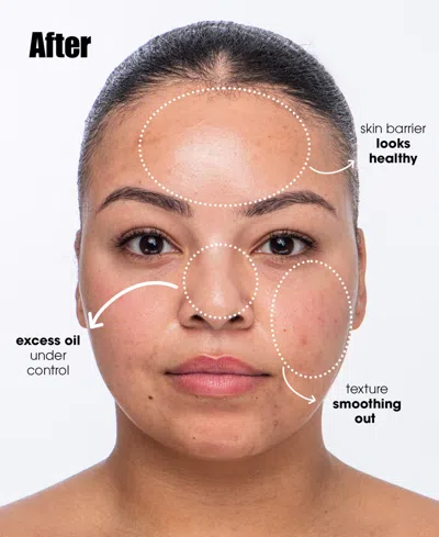 Sunday Riley Breakout Breakup Purifying Salicylic Acid Cleanser For Oily & Blemish-prone Skin, 5 Oz. In Transparent