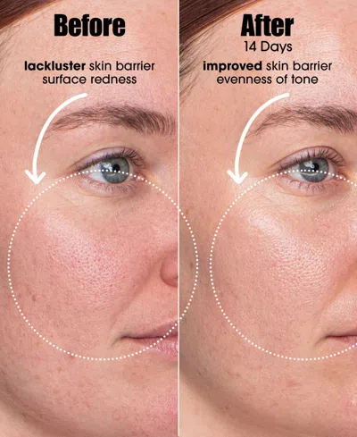 Sunday Riley Ai Smart Retinoid Serum For Blemish Prone Skin 1 Oz. In Transparent