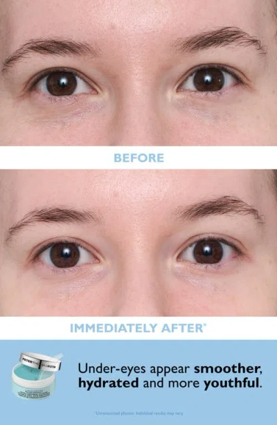 Peter Thomas Roth Patch + Go Eye Patch Travel Pack In Transparent