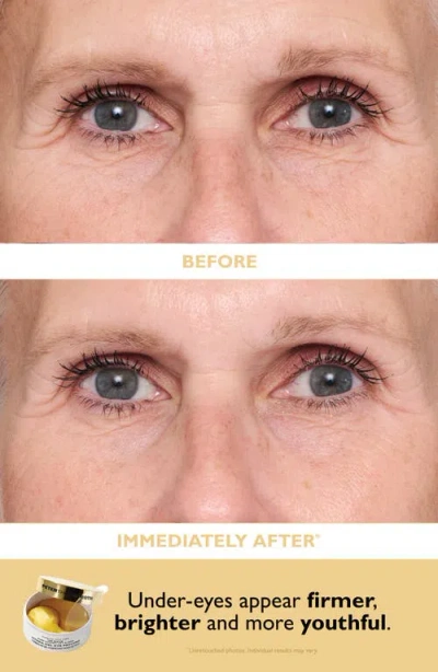 Peter Thomas Roth Patch + Go Eye Patch Travel Pack In Transparent