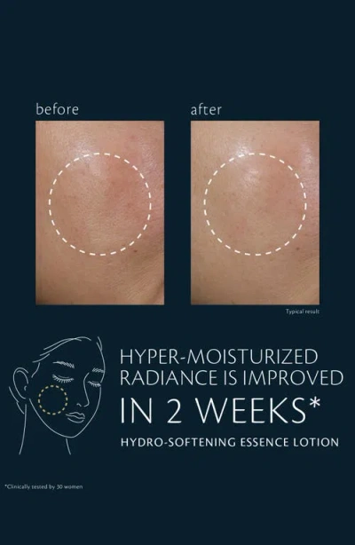 Clé De Peau Beauté Cle De Peau Beaute Hydro Softening Essence Lotion 5.7 Oz. In Brown