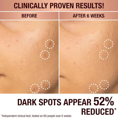 Charlotte Tilbury Dark Spot Correcting Radiance Recovery Serum