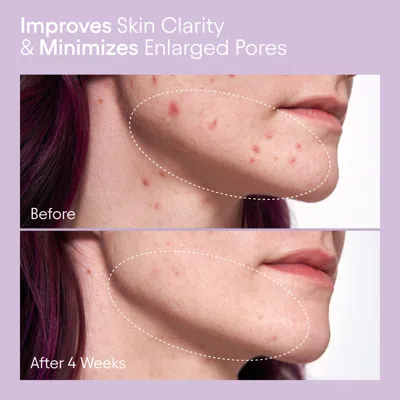 Bluemercury 2% Bha Pore Perfecting Liquid Exfoliator For Brighter And Clearer Skin