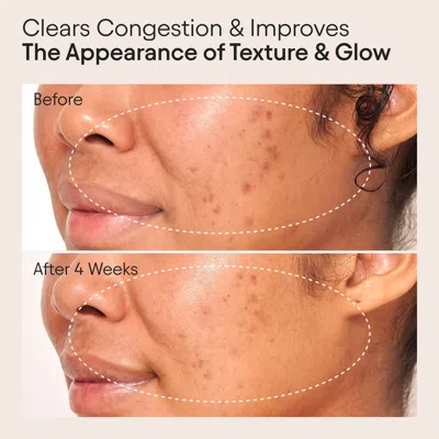 Alpyn Beauty Clarifying Facial Oil With Retinol And Pink Algae