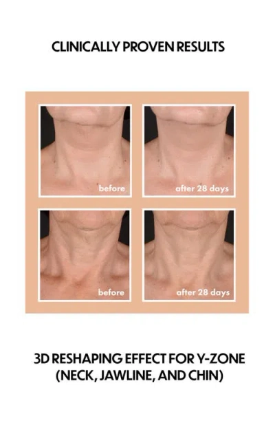 Whish Beauty Neck Firming Complex With Bakuchiol In Transparent