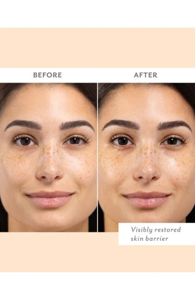 Patchology Skin Remedy Barrier-boosting Sheet Mask In Transparent