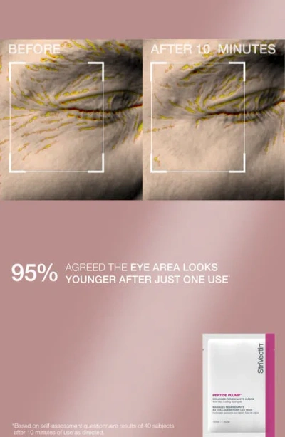 Strivectin 4-pc. Neck And Hydrating Face Cream With Serum Gift Set In Transparent