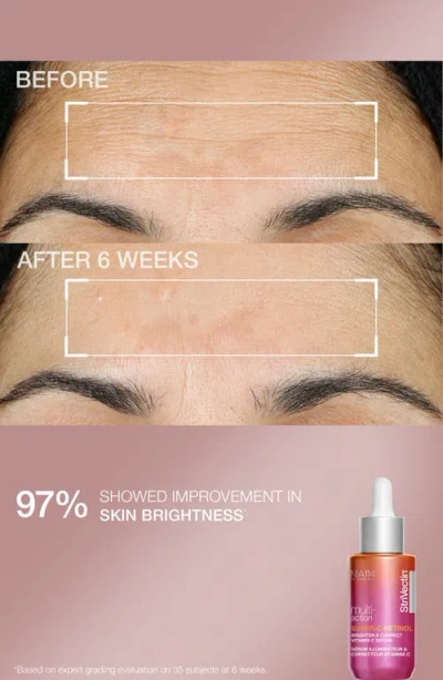 Strivectin 4-pc. Neck And Hydrating Face Cream With Serum Gift Set In Transparent