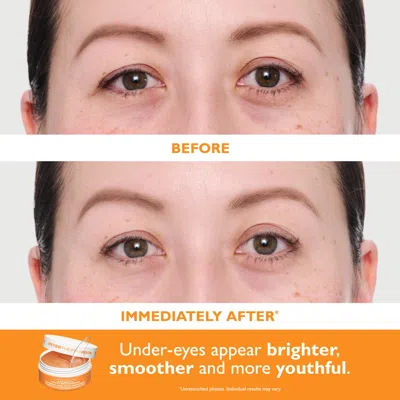 Peter Thomas Roth 2-pc. Vitamin C And Hyaluronic Eye Patches Set In Transparent