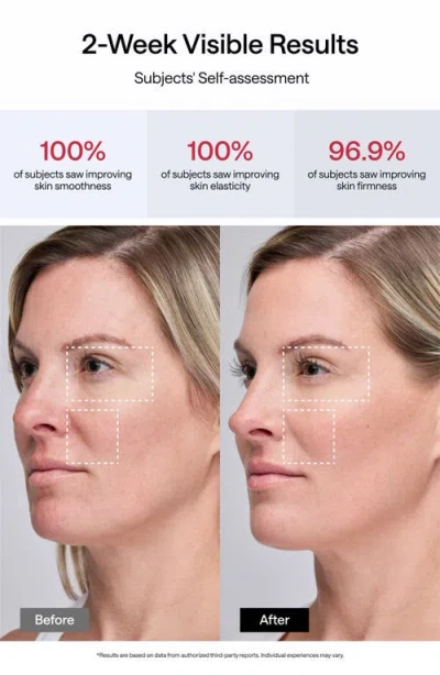 Ulike Jmoon Ucollagen+ Portable Beauty Device Set $499 Value