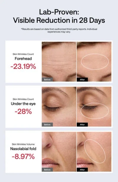 Ulike Jmoon Ucollagen+ Portable Beauty Device Set $499 Value